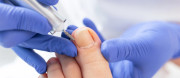 Unhas encravadas: o que causa, como aliviar e quando procurar ajuda