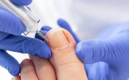 Unhas encravadas: o que causa, como aliviar e quando procurar ajuda