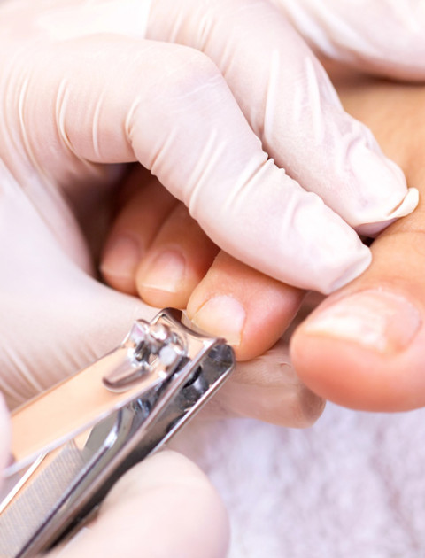 Corte Técnico das Unhas