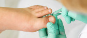 Tratamento de Unhas Encravadas